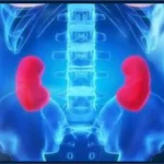 Лечение Почки